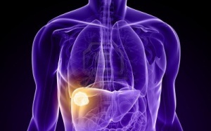 Suy gan - dễ mắc, khó chữa