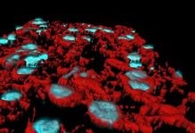 Chẩn đoán sớm ung thư bằng phương pháp “sinh thiết lỏng”