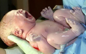 Mổ cứu kịp thời thai nhi có dây rốn bị thắt nút hiếm gặp