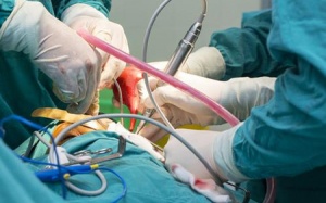 Kỹ thuật mới trong phẫu thuật: Thay máu bằng nước muối
