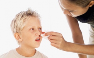 Trẻ chảy máu cam, đừng cuống