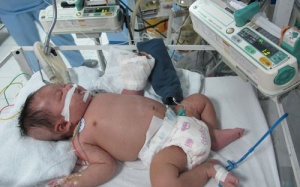 Bé sơ sinh hoại tử cả bàn tay đã tử vong