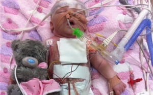 Anh: Bệnh nhi mắc bệnh tim hiếm gặp được phẫu thuật ngay khi ra đời