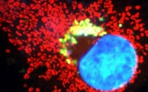 Sẽ giải quyết tận gốc vấn đề chống kháng thuốc