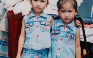 Một làng có 70 cặp song sinh