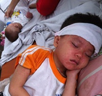 Hoang mang trước dịch sởi