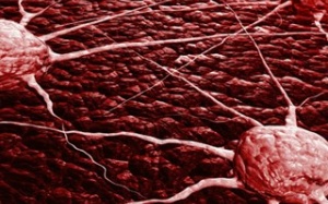 Nhật phát hiện loại enzim chặn di căn của tế bào ung thư