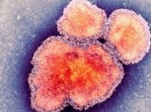 Thử nghiệm thành công thuốc điều trị sởi đầu tiên trên thế giới