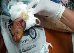 Thà mắc HIV còn hơn... tiểu đường