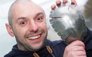 Dùng vật liệu tàu con thoi để... 'vá' sọ