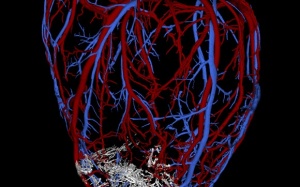 Phục hồi tim khỉ bị tổn thương bằng tế bào gốc phôi người