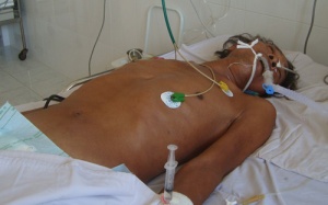 Nhậu nhộng ve sầu, 3 người nguy kịch