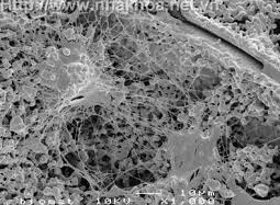 Hồi phục não nhờ tế bào gốc từ răng