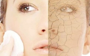 Tác hại của ăn kiêng