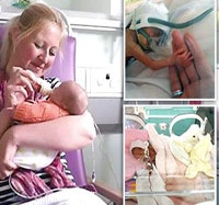 Em bé sinh non 500gram sống sót kỳ diệu