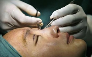 Phẫu thuật mắt miễn phí cho 174 ngư dân và người nghèo