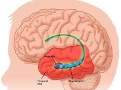 Não của người trầm cảm có cấu tạo sai lệch