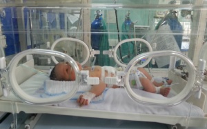 Bé 2 ngày tuổi có nội tạng chui lên lồng ngực