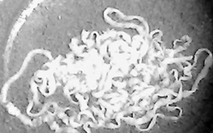 Ăn thế nào để tránh nhiễm sán?