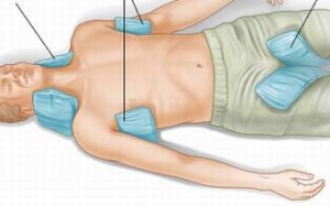 Cách sơ cứu người say nắng