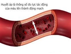 6 triệu dân Việt Nam không biết mình bị huyết áp cao