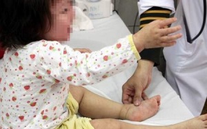 Hậu mắc sởi vẫn có thể tử vong