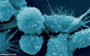 Giảm 60% ung thư tuyến tiền liệt ở nam giới nhờ...