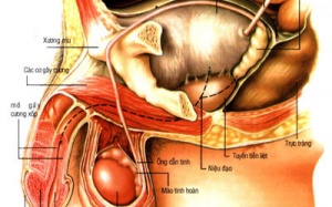 Viêm tiền liệt tuyến ở nam giới