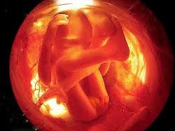 Nước ối của mẹ gây tự kỷ ở trẻ?