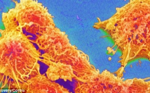 Lần đầu tiên phát triển khối u ung thư ngoài cơ thể