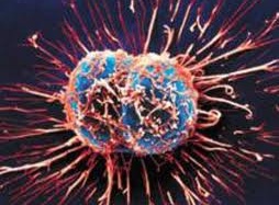 Ăn đúng - ngừa ung thư