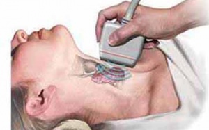 Bệnh Basedow và thai kỳ