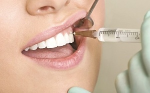 Lưu ý khi sử dụng thuốc gây tê cục bộ