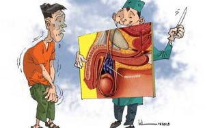 20 tuổi, bị giãn tĩnh mạch tinh?