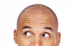 Bước tiến mới trong điều trị chứng vô mao