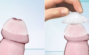 Bao cao su làm tăng cảm giác