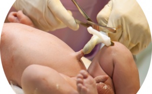 Cắt rốn bằng kéo, bé sơ sinh nguy kịch