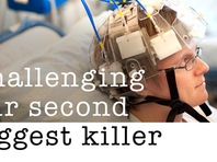 'Chiếc mũ' phát hiện đột quỵ