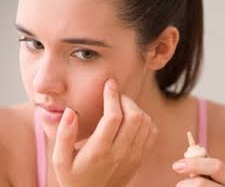 Thuốc trị mụn thông thường có thể gây phản ứng nghiêm trọng