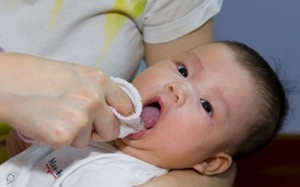 Các bệnh răng miệng phổ biến ở trẻ