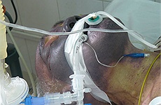 Ăn tiết canh: Sướng mồm, mất đời