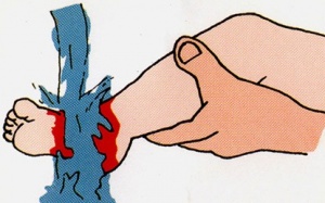 Những kỹ năng sơ cứu cho trẻ nhỏ