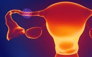 Dấu hiệu mang thai ngoài tử cung