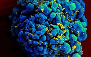 Bé gái 4 tuổi “được chữa khỏi HIV” lại tái nhiễm