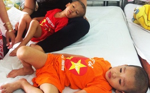 Hai anh em cùng bị viêm não do virus đường tiêu hóa