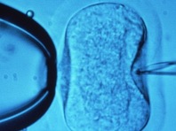 Chữa vô sinh rẻ bằng công nghệ mới