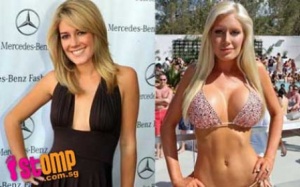 7 lý do nên tránh xa phẫu thuật thẩm mỹ