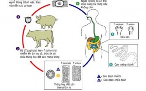 Ăn tái, sống sán dải bò đầy quần