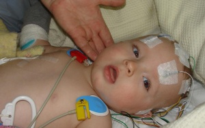 Xuất huyết não vì mẹ lắc con