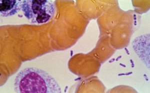 Phát hiện dịch hạch thể phổi ở Trung Quốc